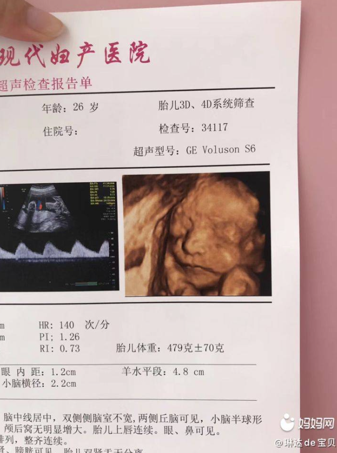 图片[2]-智能AI预测婴儿四维彩超_小众副业（附教程）